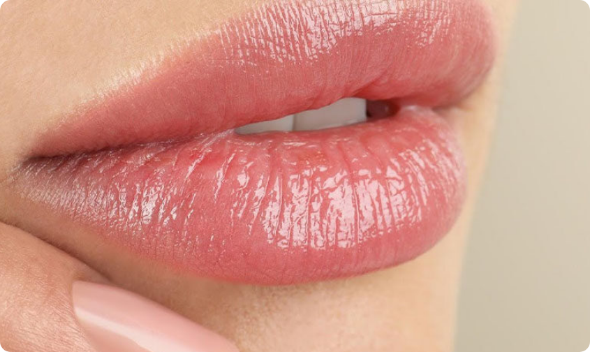 preenchimento-labial-em-florianopolis-1170x457